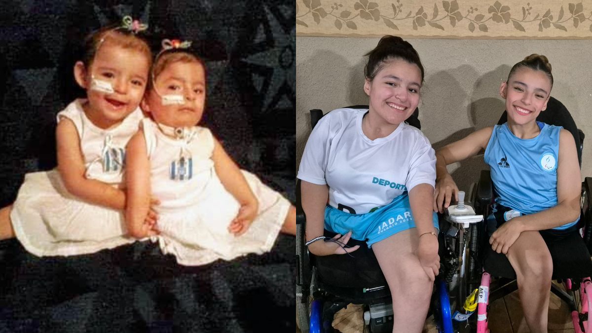 Almirante Brown: siamesas separadas que brillan en deporte adaptado