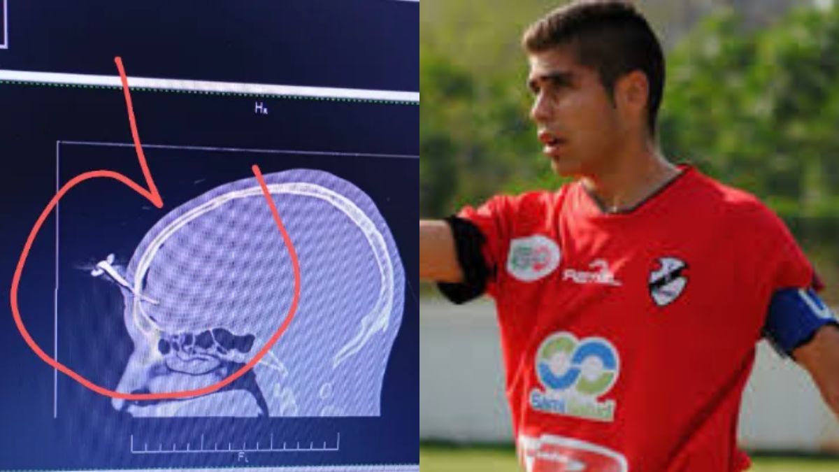 Colecta para ayudar al ex jugador de Claypole herido con llave de auto